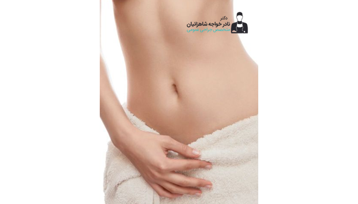 شکم تخت بعد از ابدومینوپلاستی