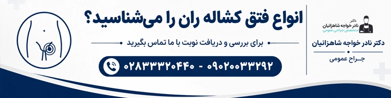 انواع فتق کشاله ران