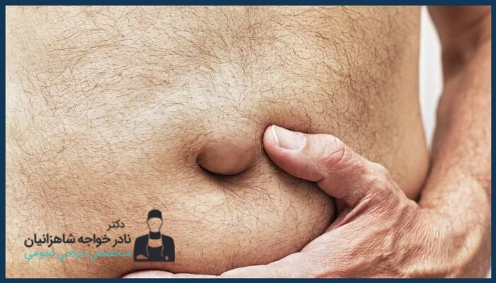 روش‌های تشخیص فتق نافی
