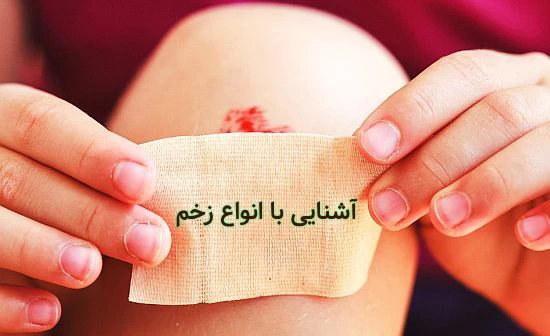 انواع زخم