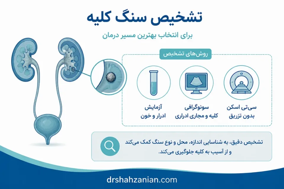 نمای توضیحی درباره سنگ کلیه؛ علائم و راههای پیشگیری